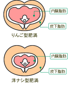 リンゴ型肥満と洋ナシ型肥満